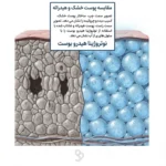 تاثیر هیالورونیک اسید واتر ژل نوتروژینا بر پوست دهیدراته